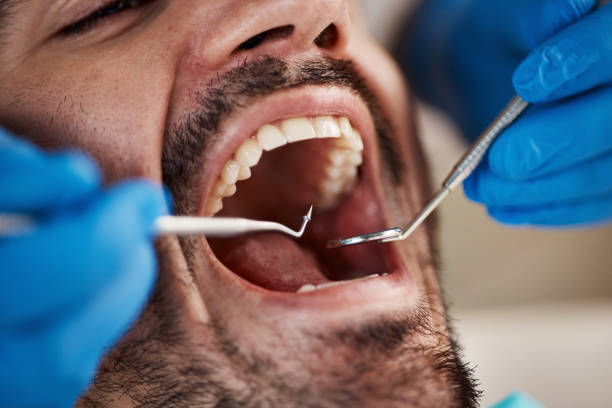 Best Pediatric Emergency Dentist in Rockingham, NC