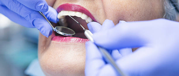 Best Emergency Treatment for Dental Infections or Abscesses in Rockingham, NC